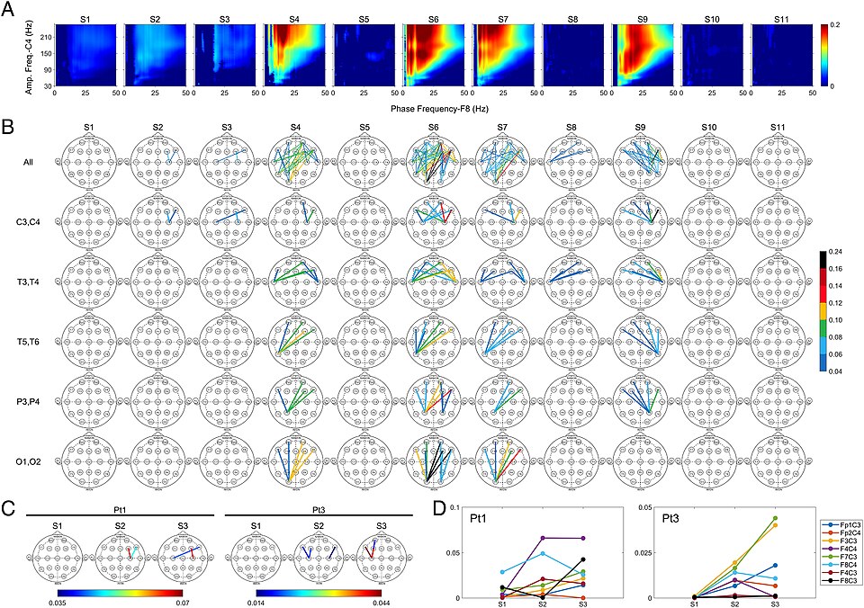Increase of Cross-Regional Phase-Amplitude Coupling at Near-Death