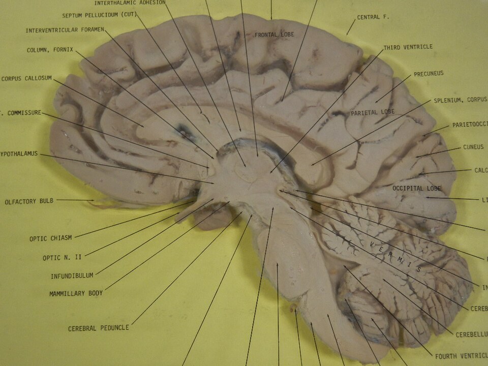 Human Brain Sagittal Section